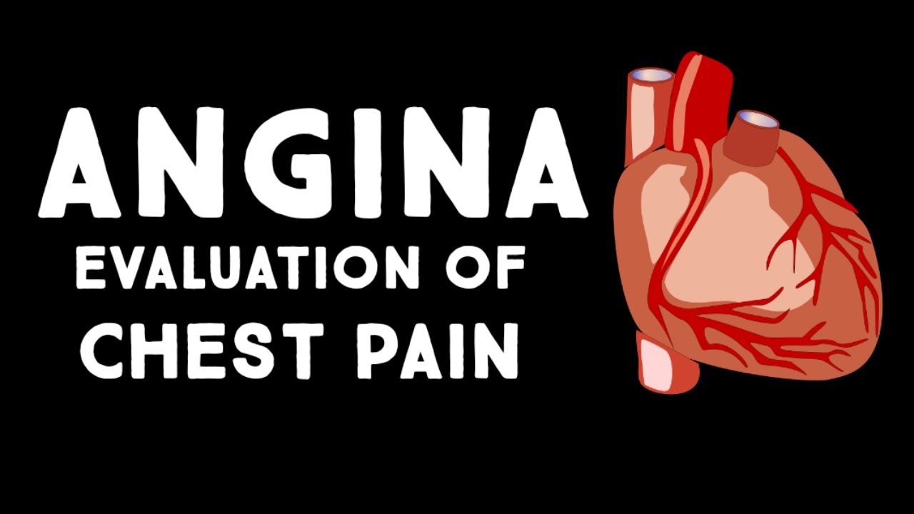 Angina Pectoris A Sign of Heart Trouble