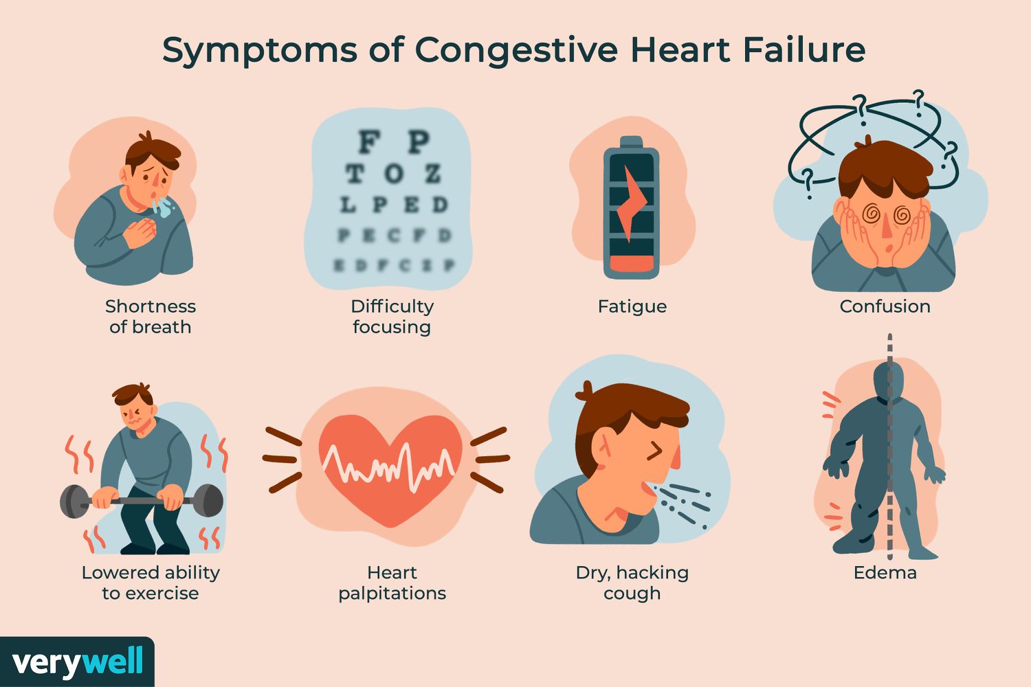 Heart Failure A Complex Condition