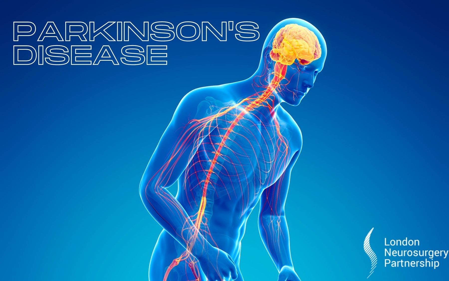 Parkinson’s Disease A Neurological Disorder