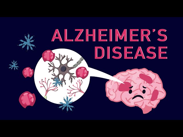 Alzheimer’s Disease A Degenerative Brain Disorder