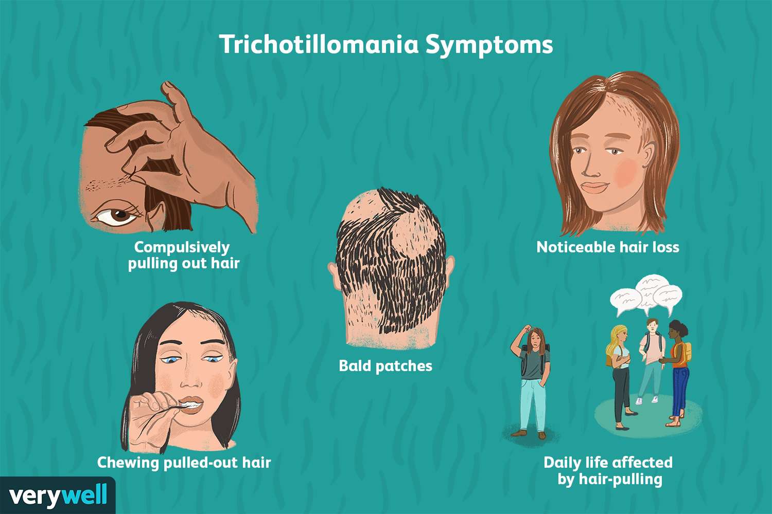 Trichotillomania